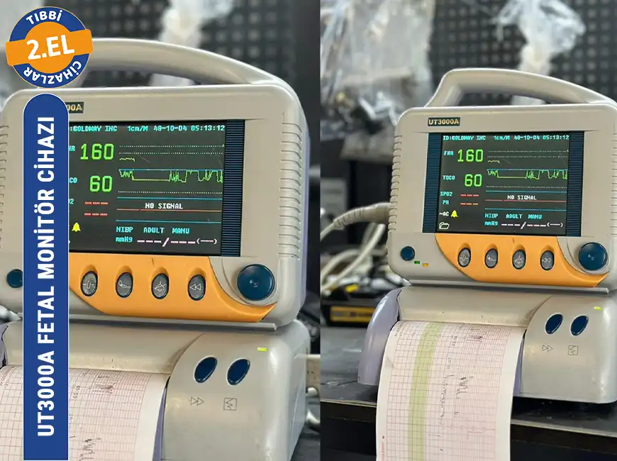 İkinci El NST Cihazı